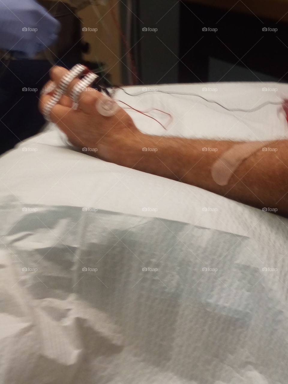 husband is getting a nerve test done for his wrist. his hand is hooked up to a machine.