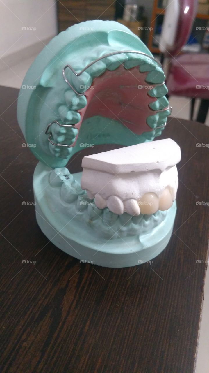 Creepy braces mouth model