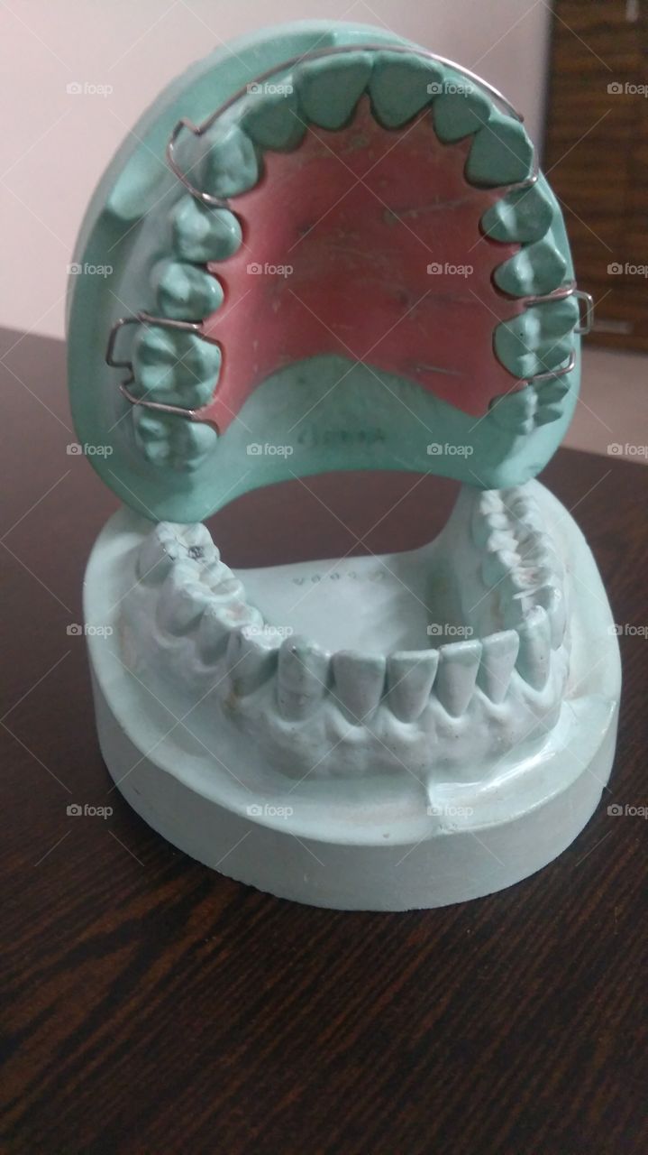 Braces teeth model