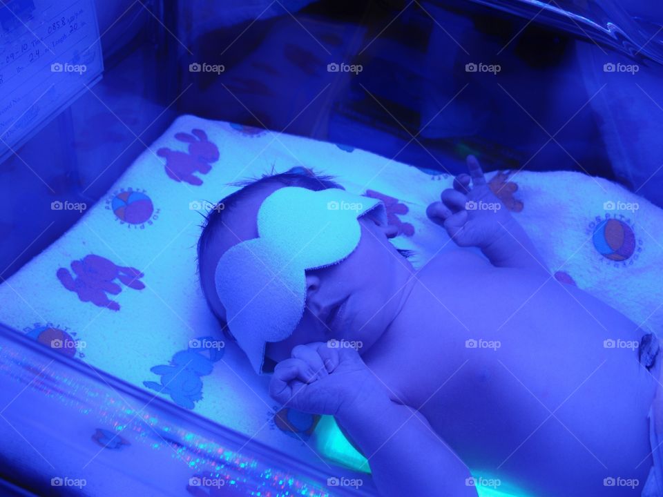 Newborn Under Ultraviolet Lights
