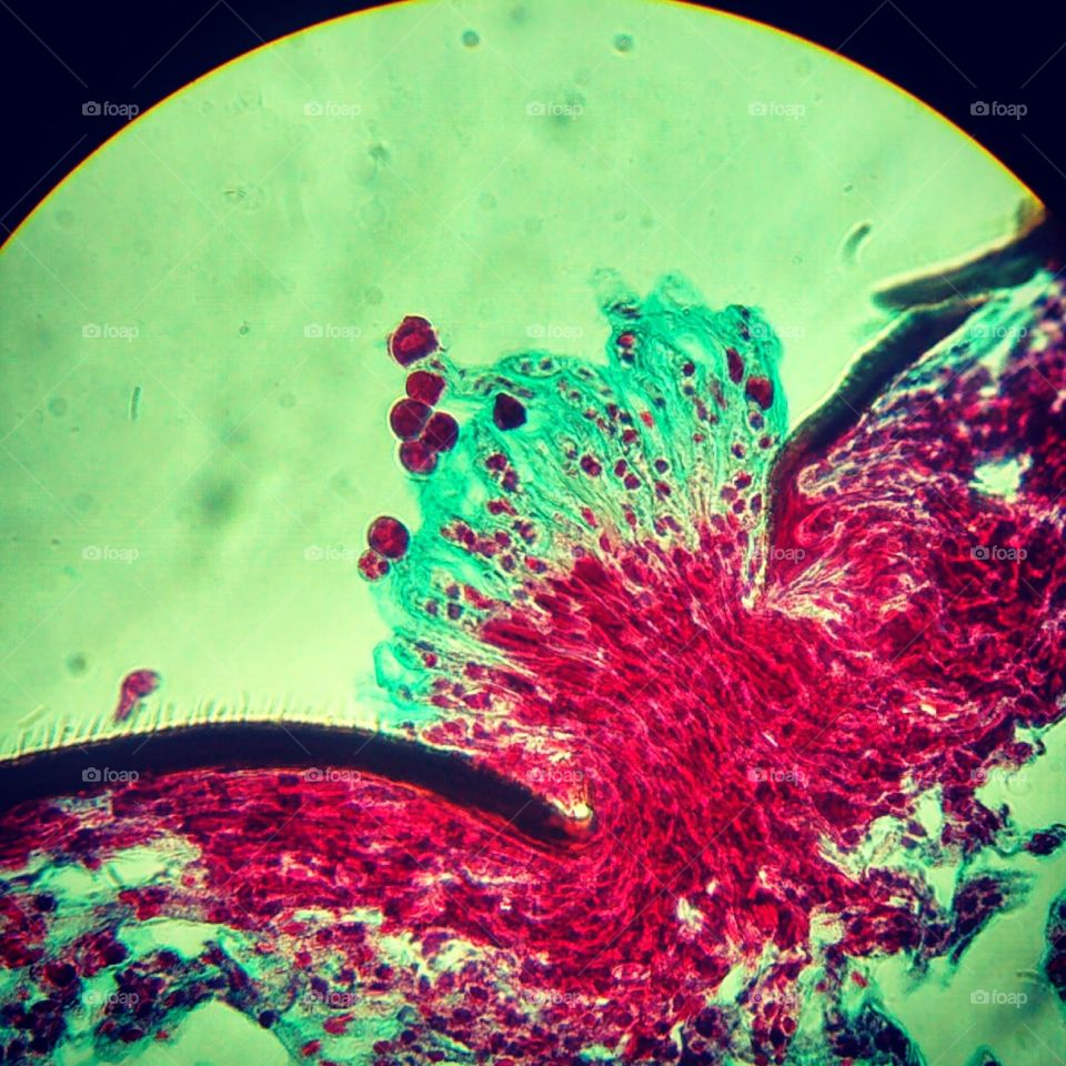 Entomophthora muscae, hongo parásito al microscopio.