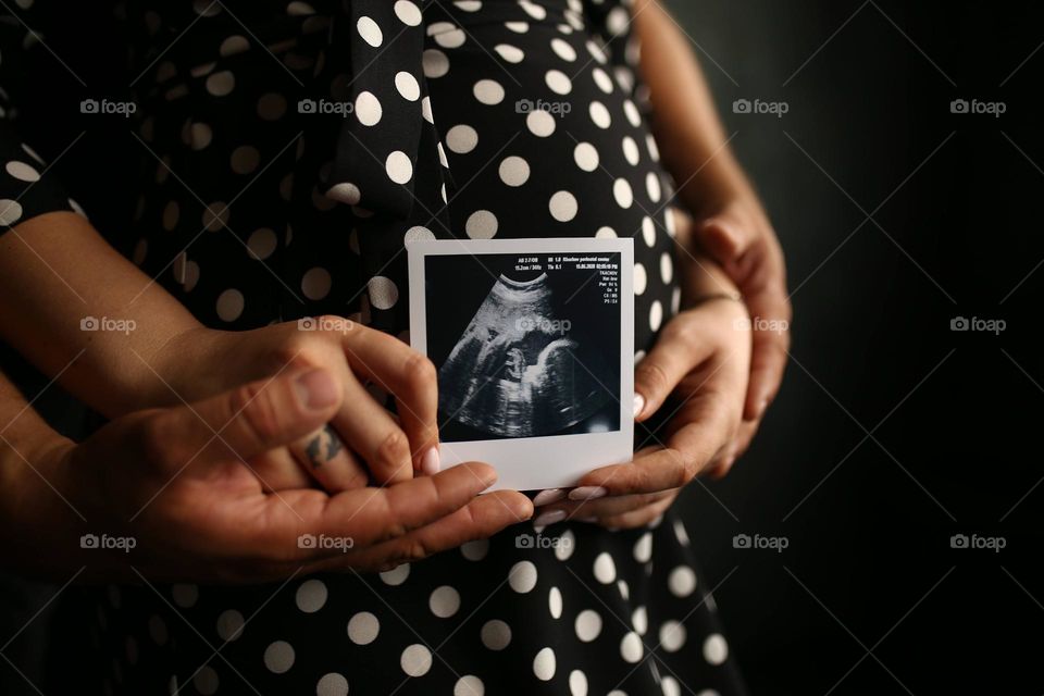 Waiting for baby in black polka dot dress. Holding hands. Holding first photo