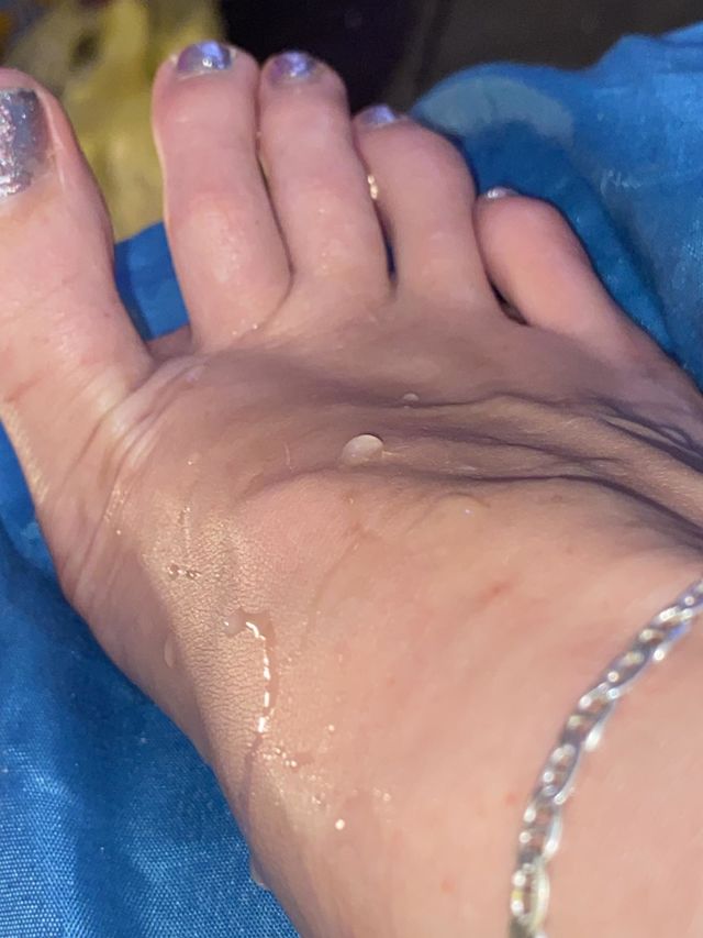 Wet feet