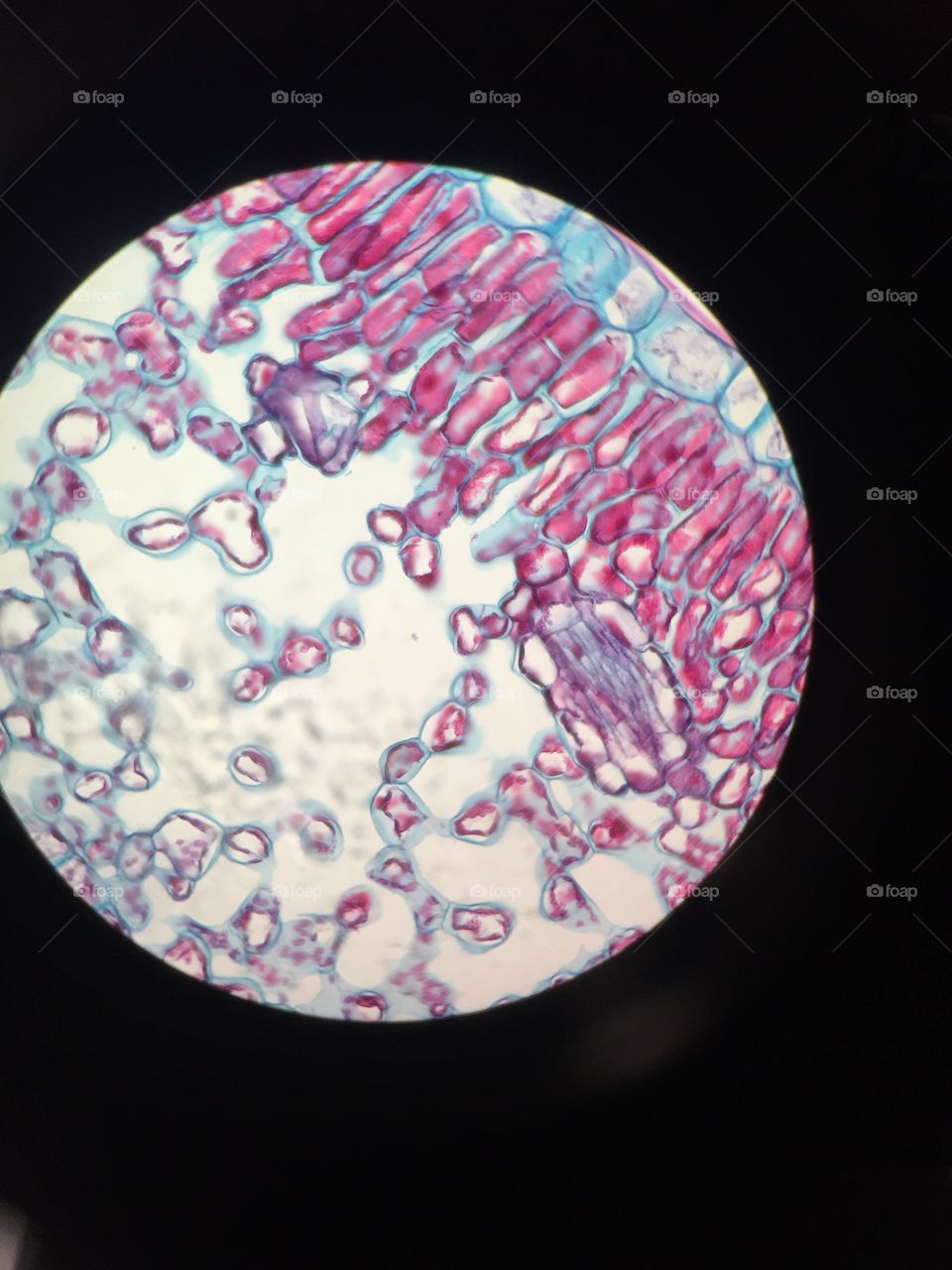 Microscopic bacterium 