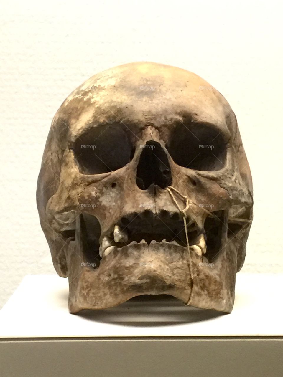 Skull