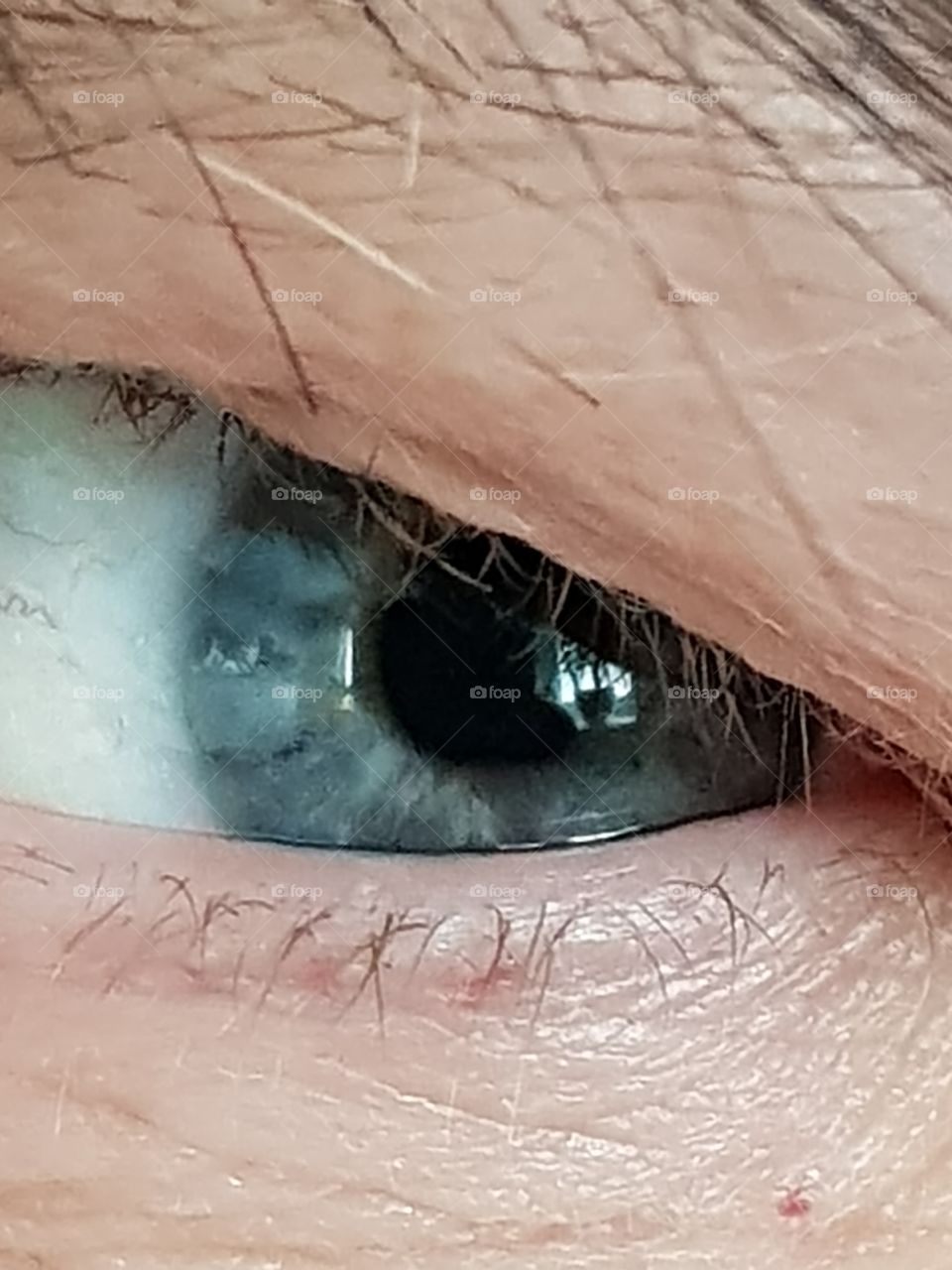 eye