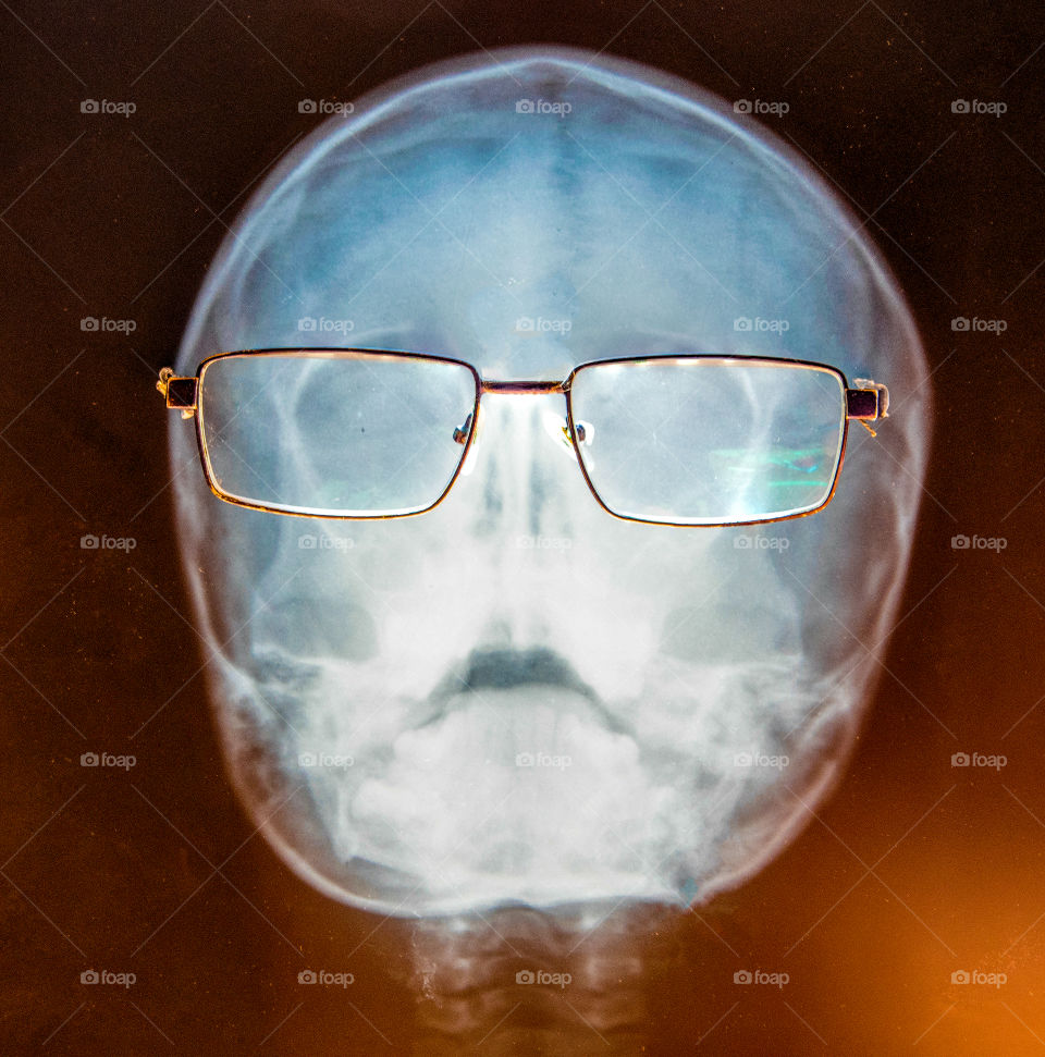 X-ray of a skull simulating correcte vision