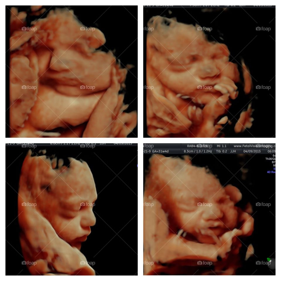 4D Ultrasound. This is what I live for and she is all mine