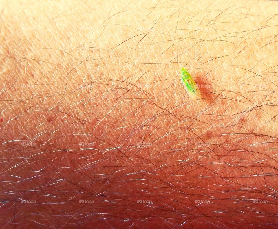 Bug on Skin
