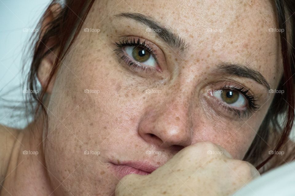 Freckles on woman's face