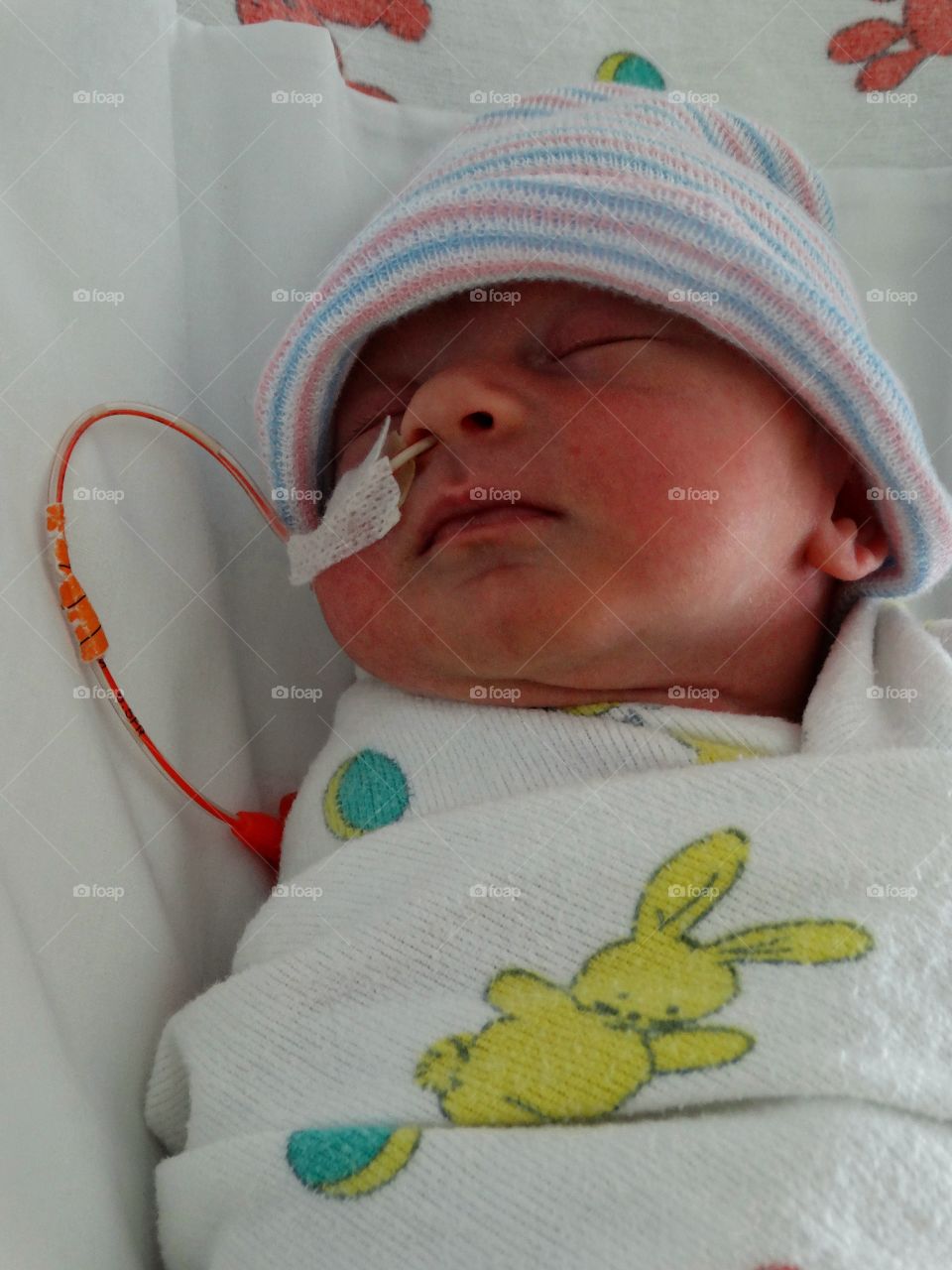 Newborn Premature Infant In Intensive Care
