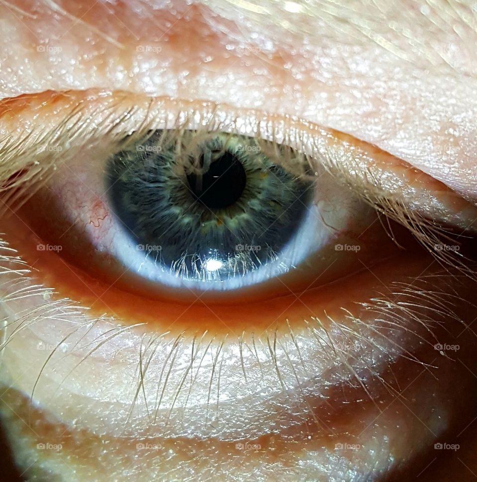 eyeball
