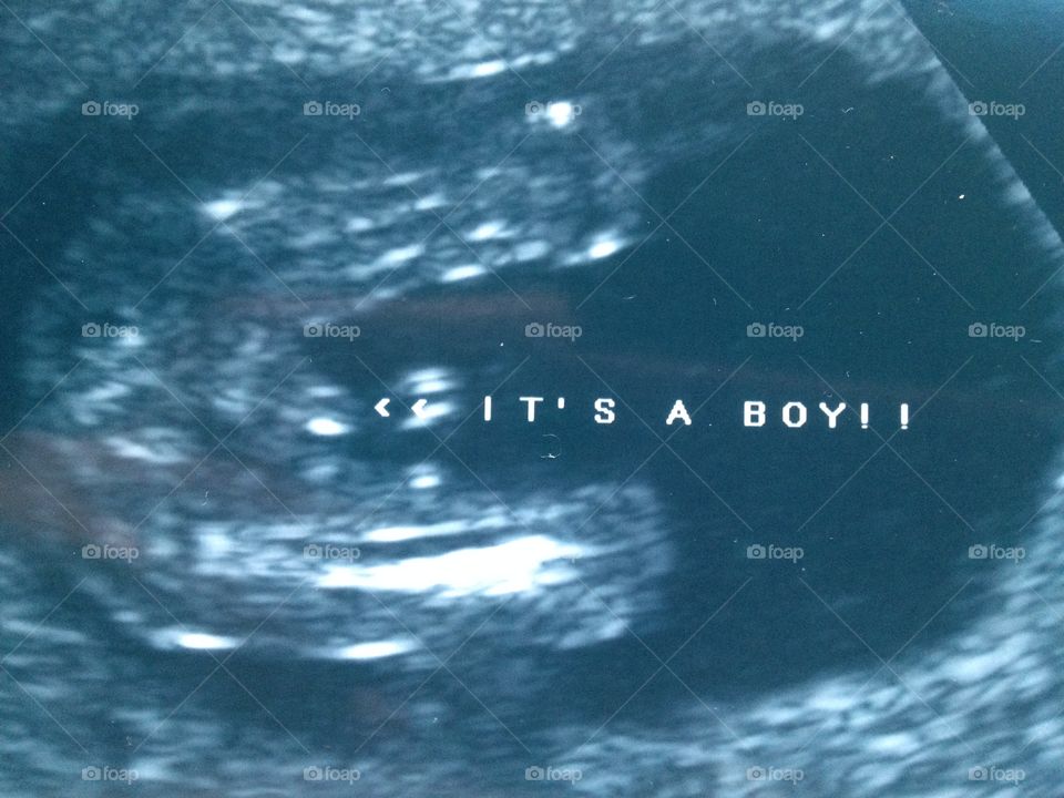 It's a boy!!. Ultrasound