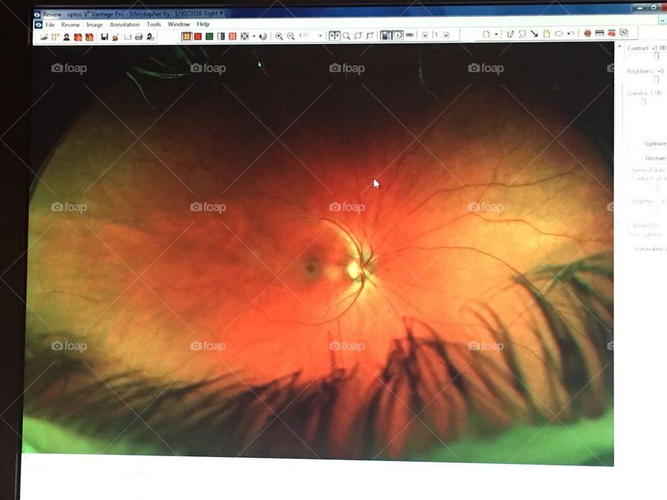 After an eye exam they allowed me
To take a picture of the picture of the thing that lets me see picture 