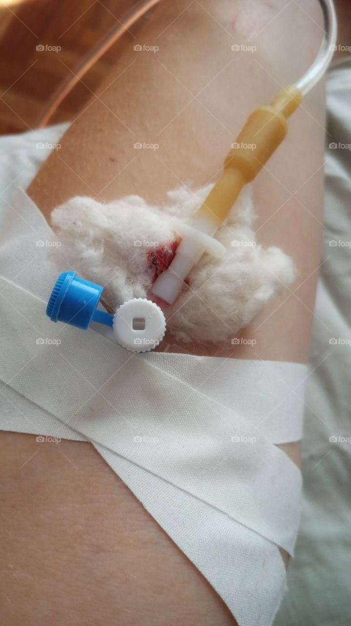 every day we care, worry, fear for others (children, parents, husbands, friends) but we do not pay the necessary attention to ourselves. And the consequences can be unpredictable😔