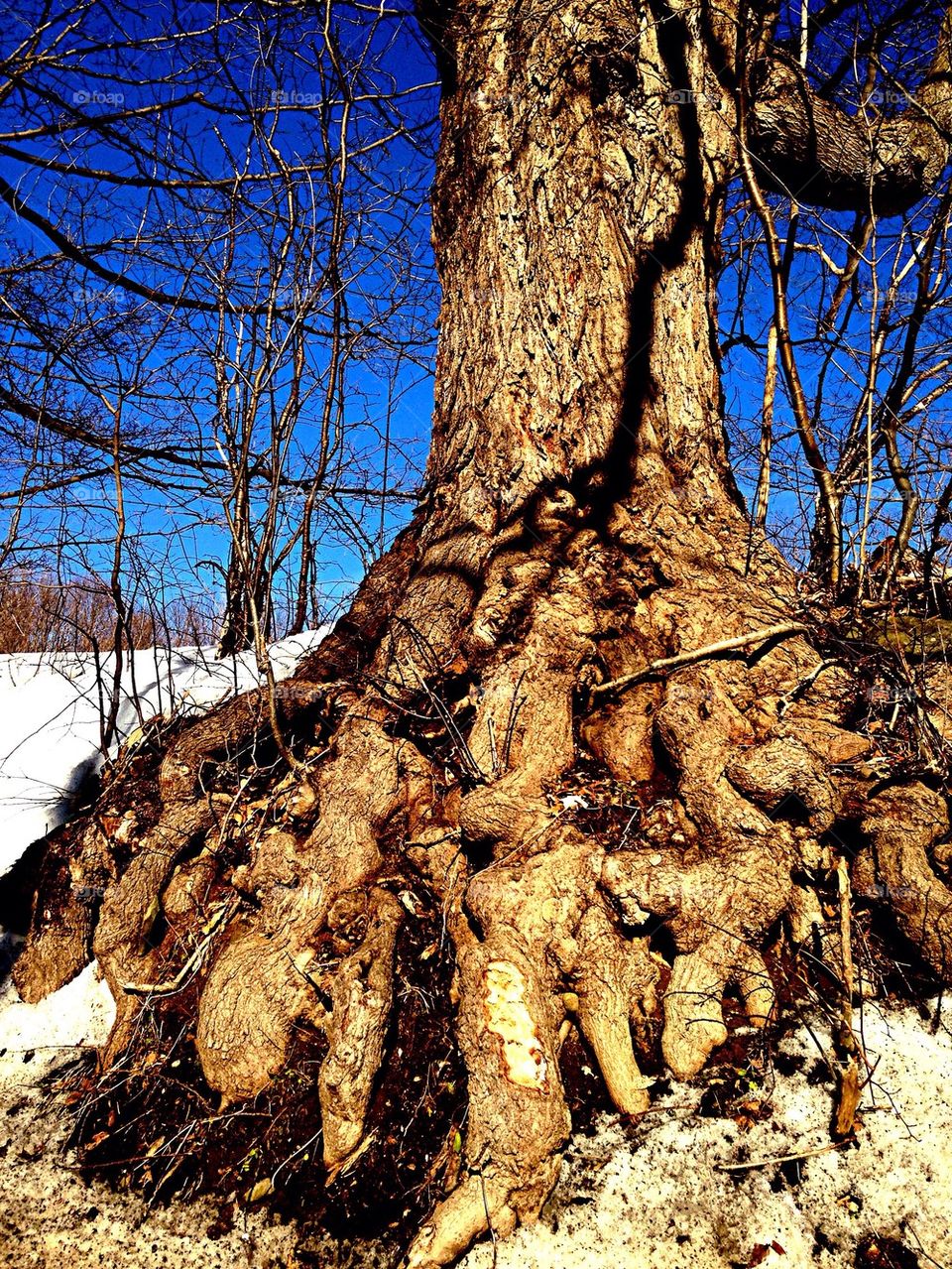 Exposed tree roots