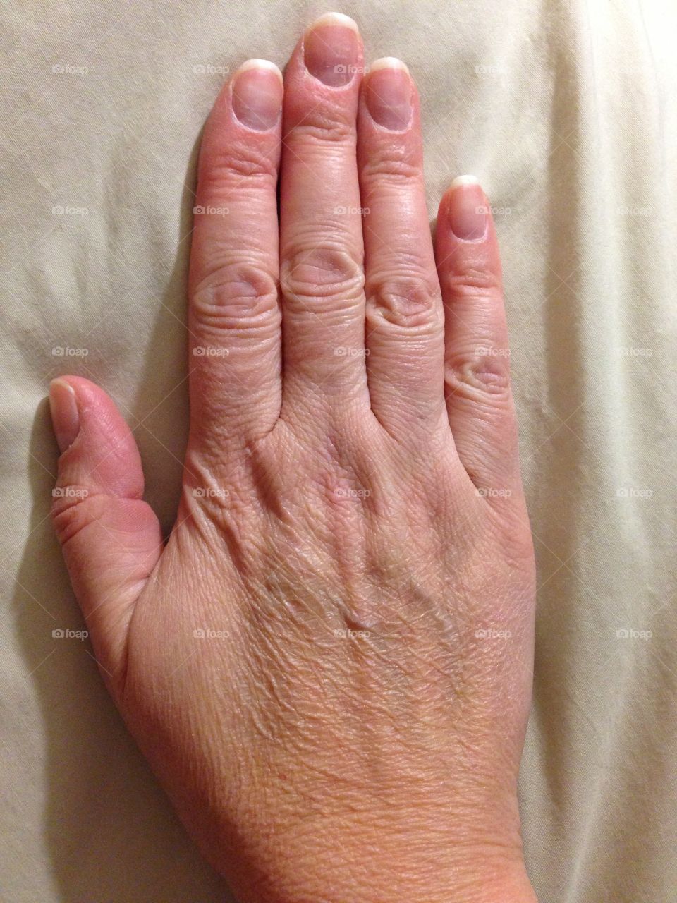 This is the right hand of a 44 year old right-handed Caucasian female.