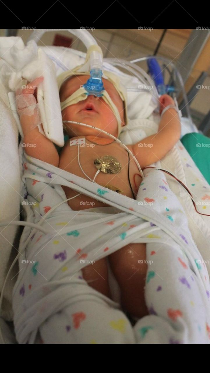 Newborn on breathing  machine