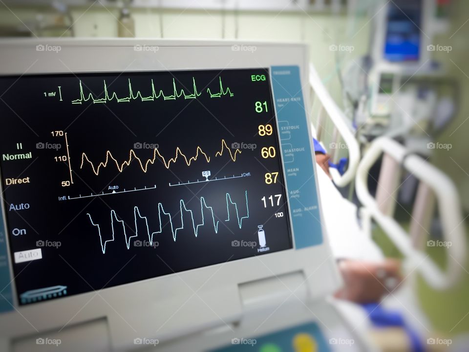 Close up EKG monitor in intensive care unit in hospital