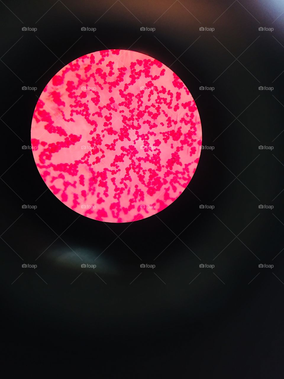 This is how red blood cells seen through microscope 🔬