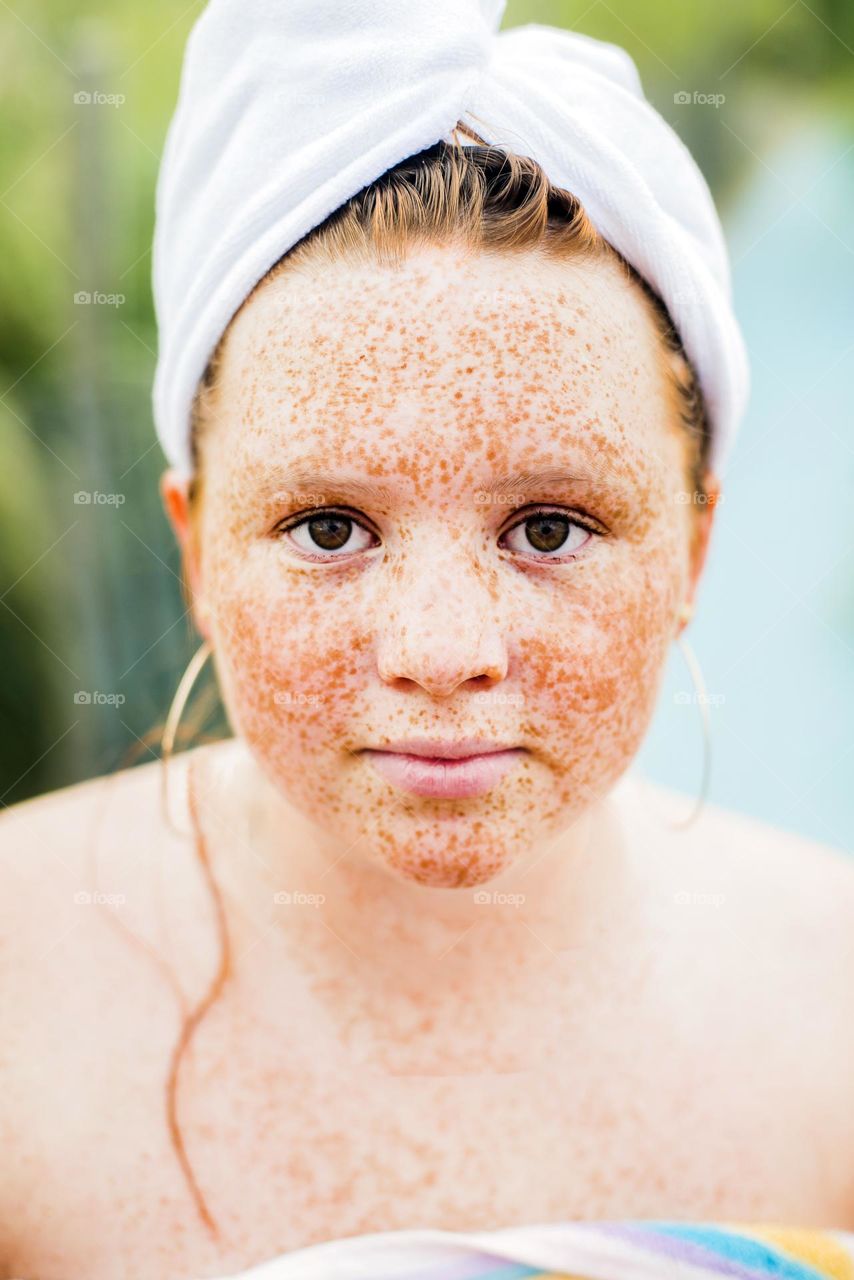 Freckle face