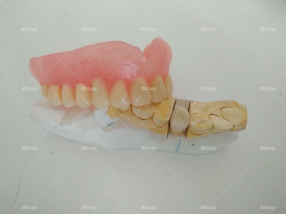 Dental composition