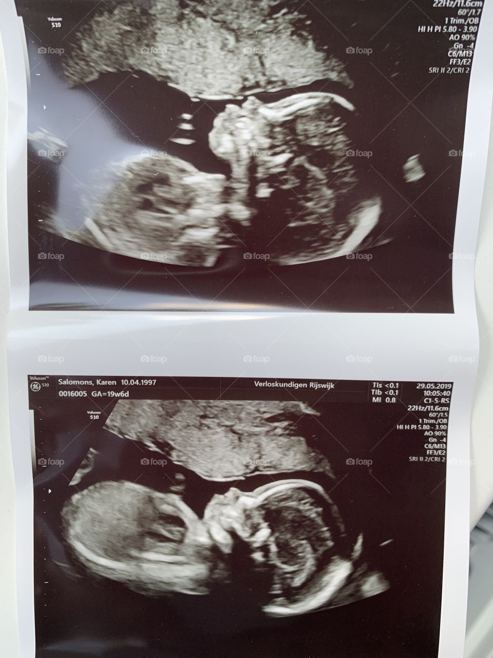 Just found out that I’m having a beautiful baby boy!!