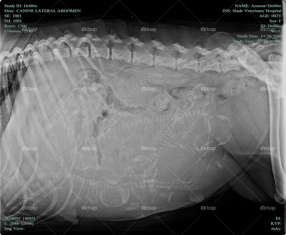 Bone, Diagnosis, Radiography, Frame, Anatomy