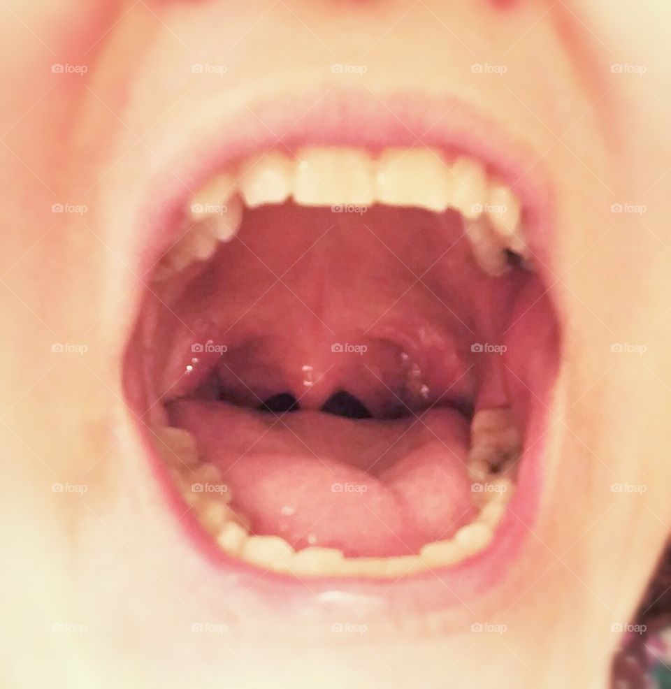see my tonsils?