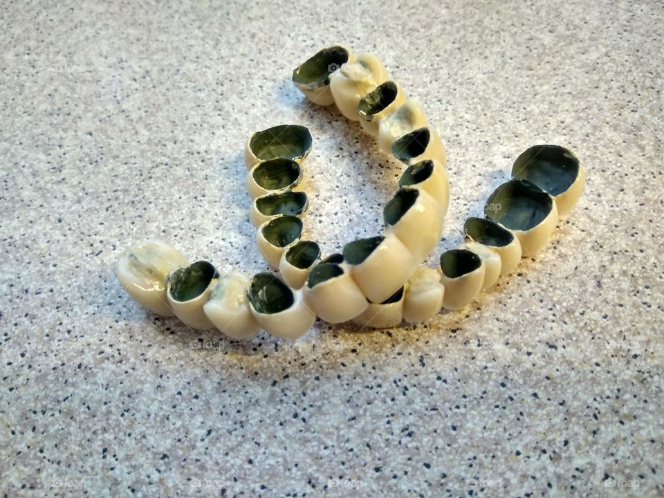 Dental ceramic bridge