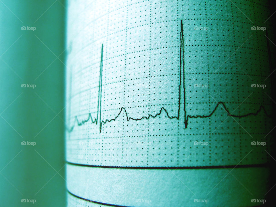 Sinus Heart Rhythm On Electrocardiogram Record Paper Showing Normal P Wave, PR and QT Interval and QRS Complex, EKG paper