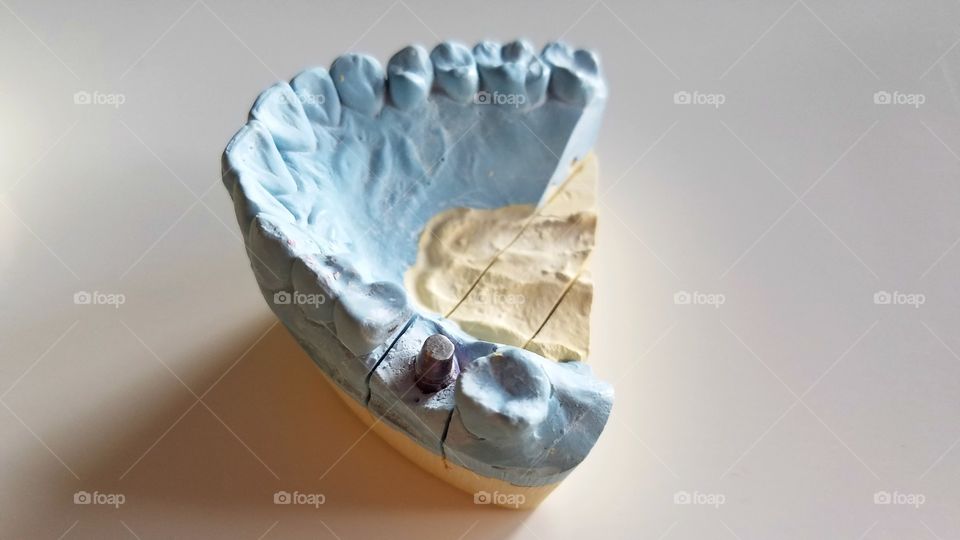 Dental impressions