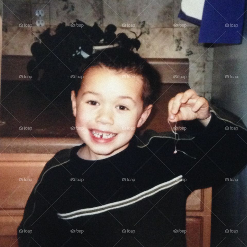 Pulled out first tooth