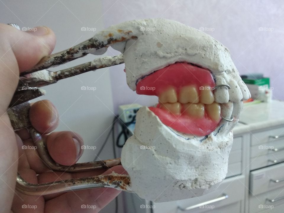 Dentures from wax