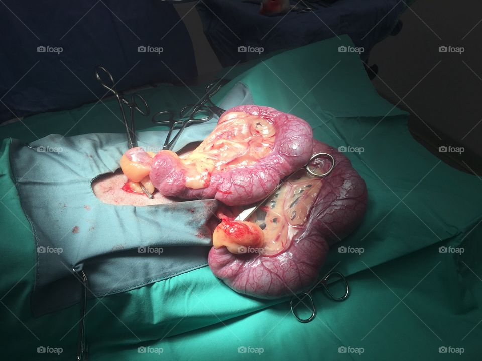 Emergency pyometra surgery at work on a 20 lb shiba inu. This uterus weighed 3 lbs. 