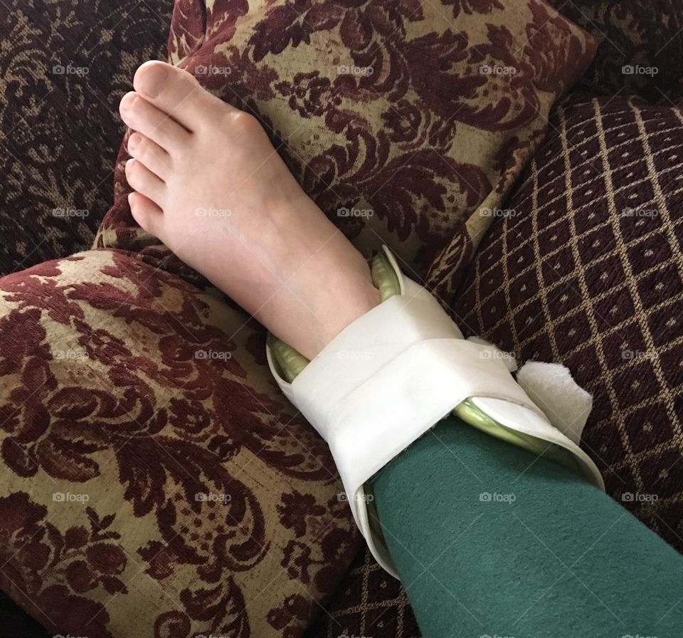 A woman’s injured foot in an ankle brace rests on a pile of sofa cushions