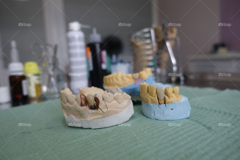 Dental implants model ceramic