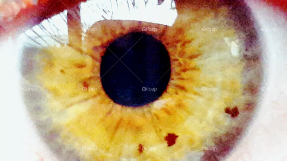 Hazel eye