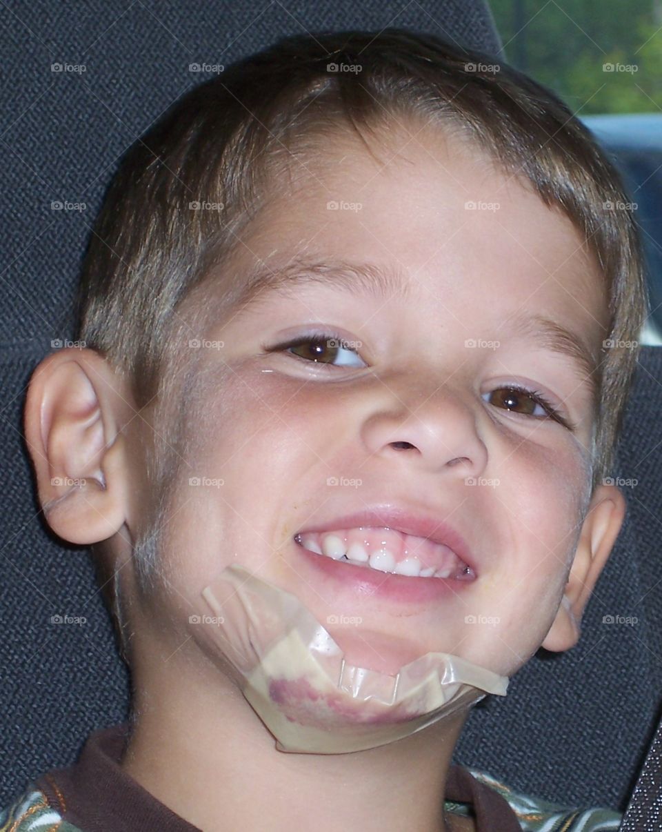 Boy smiling with chin bandaged from injury