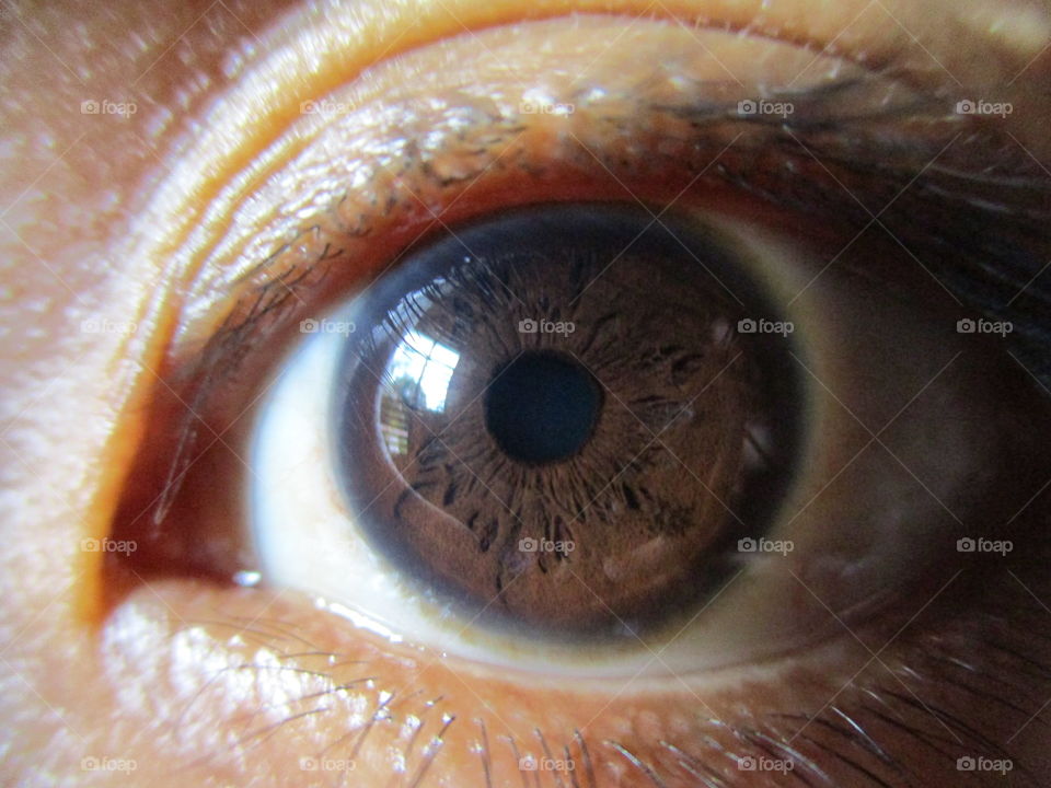 iris eye