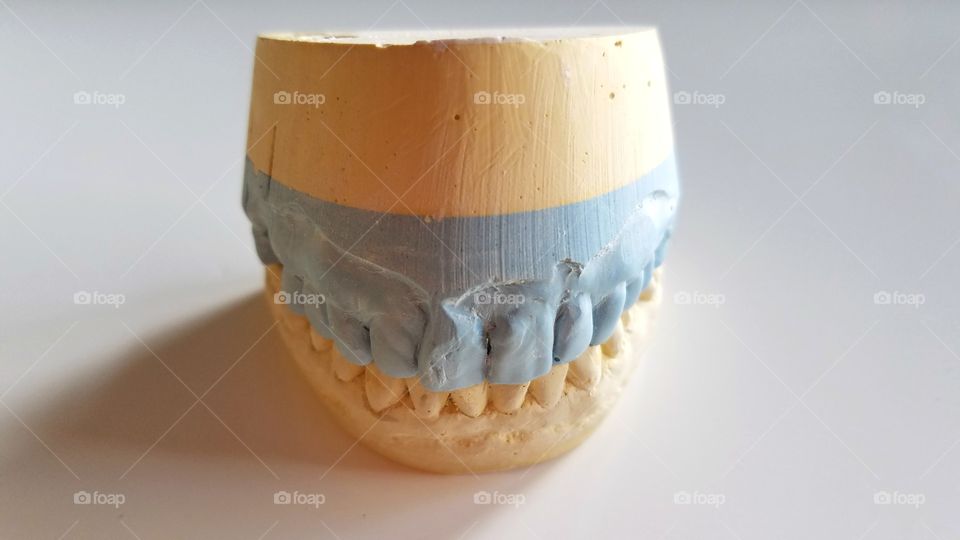 Dental crown molding