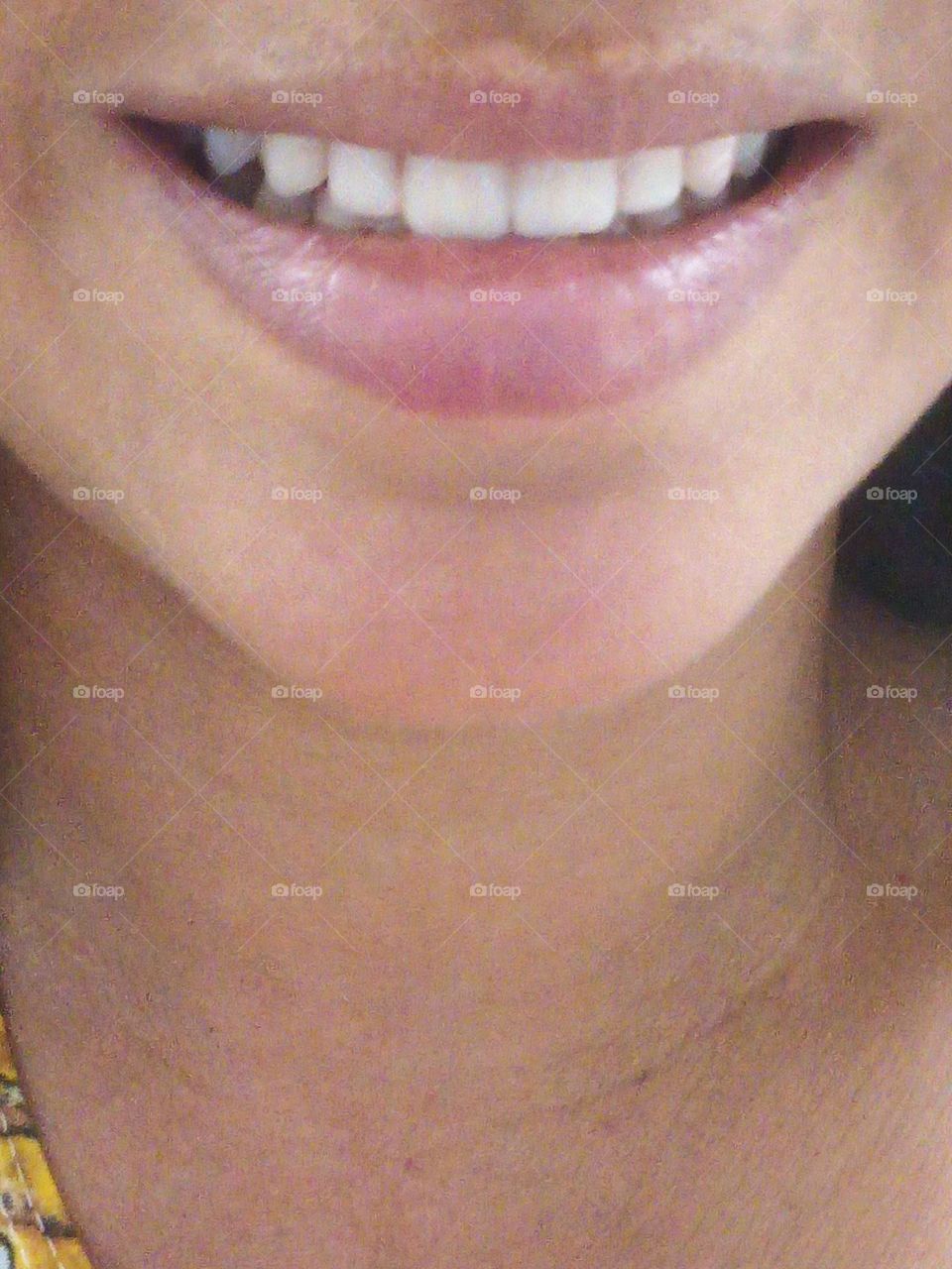Dentes perfeito 😍