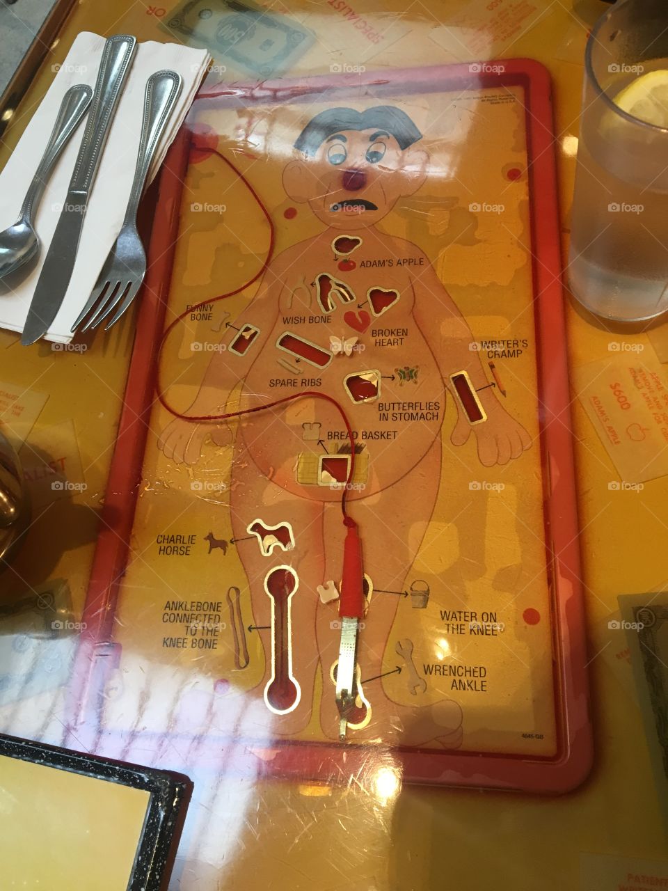 Operation game in the table at the Rudy can't fail cafe 