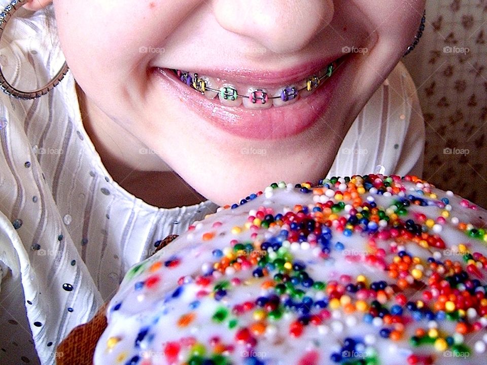 Colorful braces