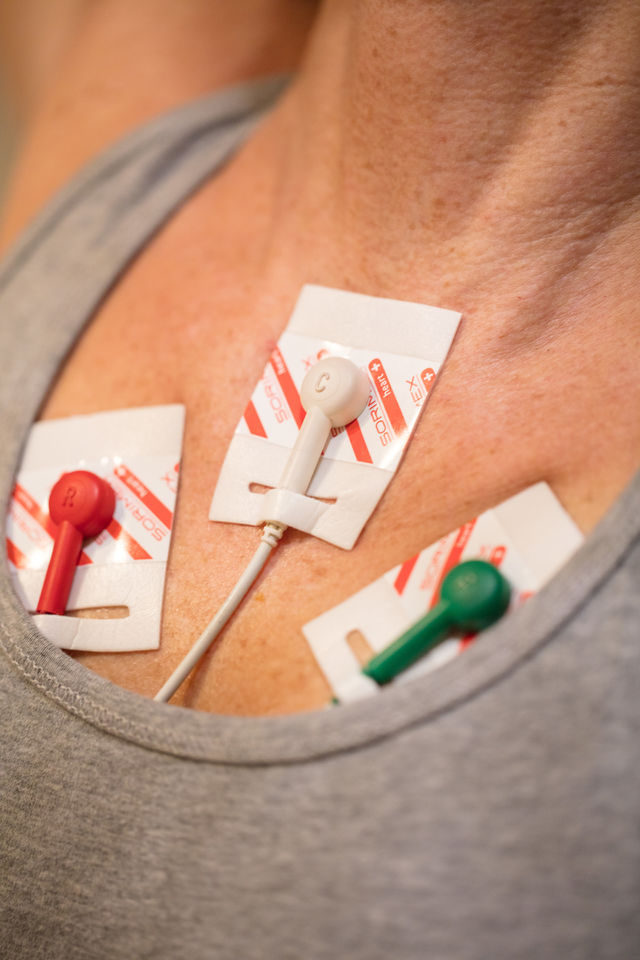 ECG