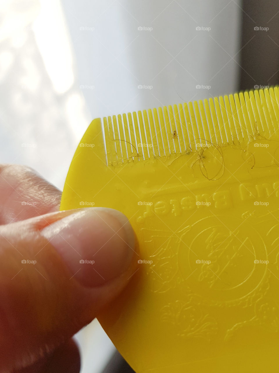 Head lice on yellow comb with thumb holding the comb in front of a window