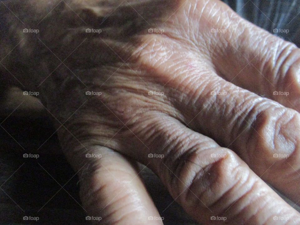 aging hand