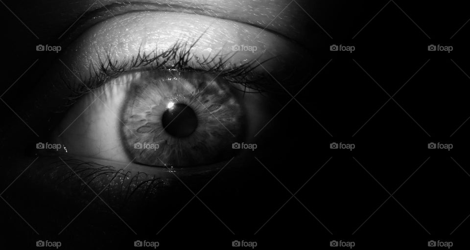 Black and white eye