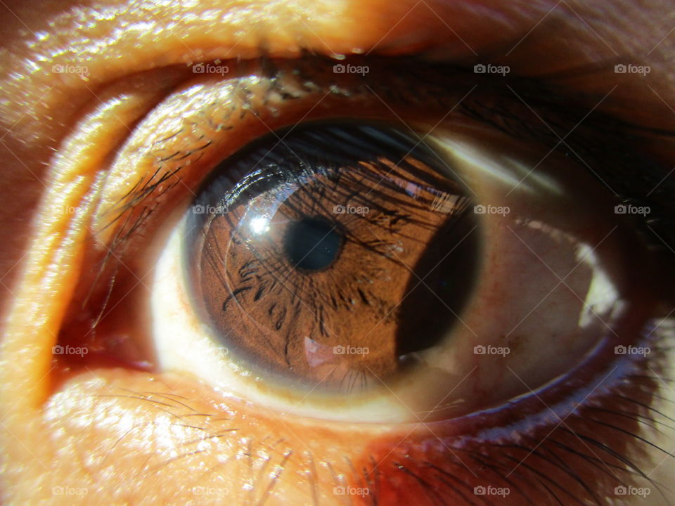 iris eye