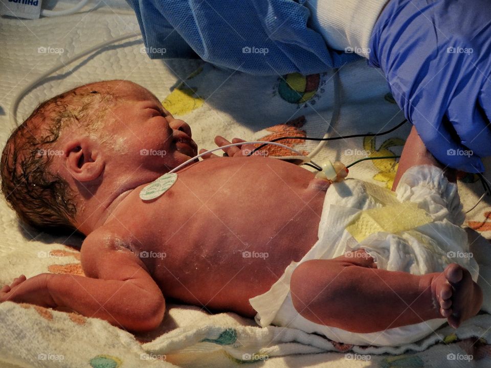 Premature Infant In Intensive Care